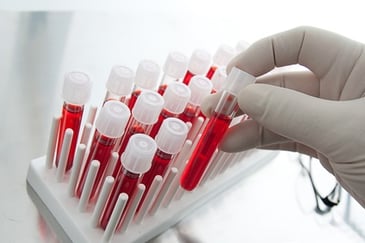 Blood Testing: Market Diagnostics