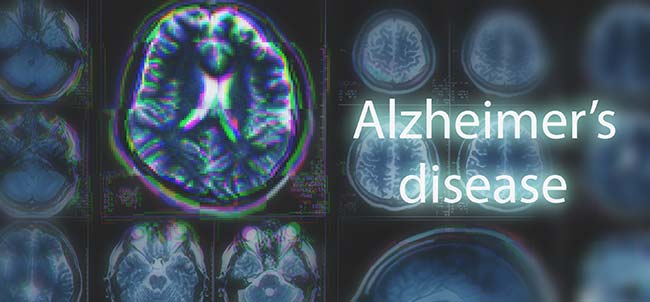 AI and Alzheimer’s Disease: Market Trends You Need To Know