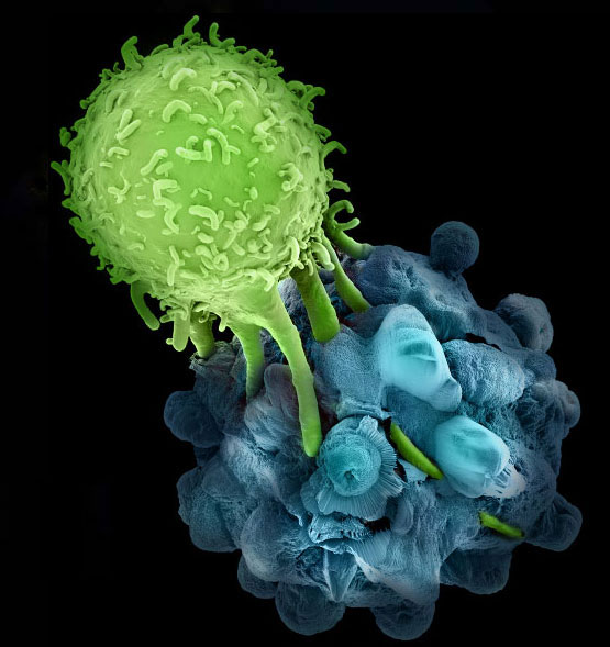 Enthusiasm for Cancer Immunotherapy Remains Unchecked