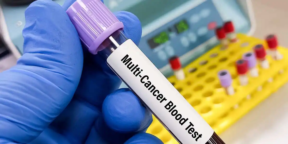 Why is the Global Market for Multi-Cancer Tests Seeing a Surge in Demand?