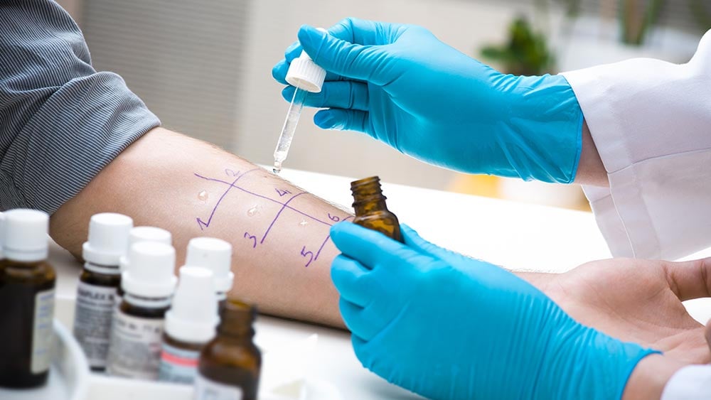 The Allergy Skin Test Market: 5 Essential Insights for 2024