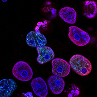 7 Breakthroughs Transforming the Cancer Immunology and Oncolytic Virology Market